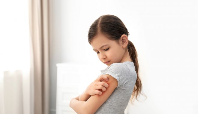Factori care agravează psoriazisul la copii - psoriazis-1709901890.jpg