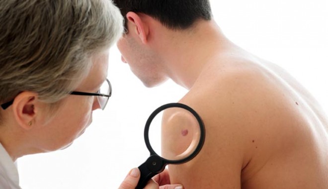 Psoriazis, boala care face mai multe victime decât cancerul - psoriazisulboalacare-1409062048.jpg