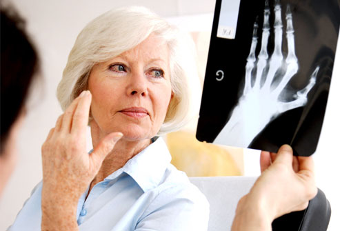 Bolile care macină oasele - rheumatoidarthritis-1316725174.jpg