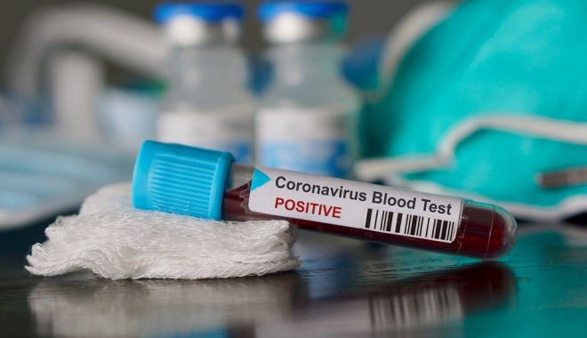 Încă noi 10 cazuri de infectare cu virusul Covid-19! Cifra bolnavilor crește cu repeziciune, în România - romania-1584377748.jpg