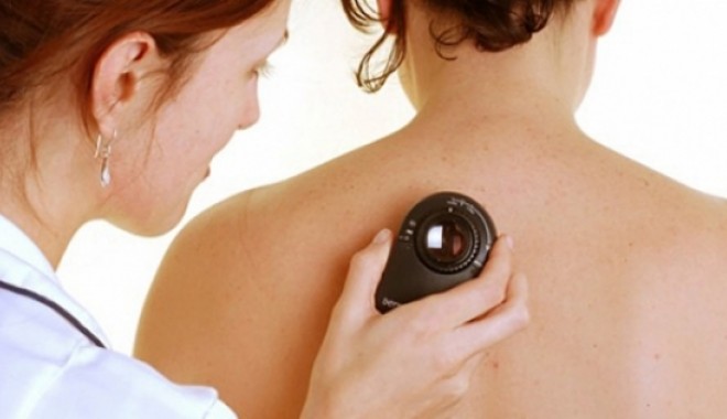 Ghid național pentru o gravă afecțiune - s560x316dermatologie-1412252055.jpg
