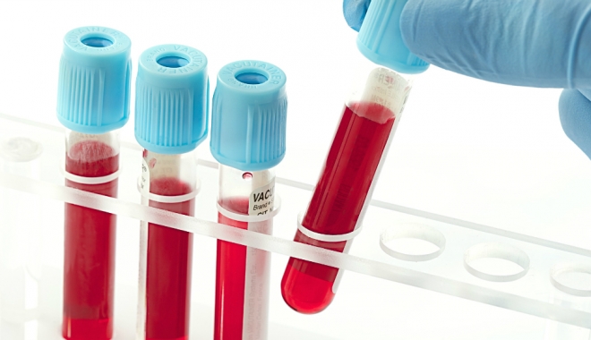 Cancerul ovarian ar putea fi detectat printr-un test de sânge - sange-1499341064.jpg