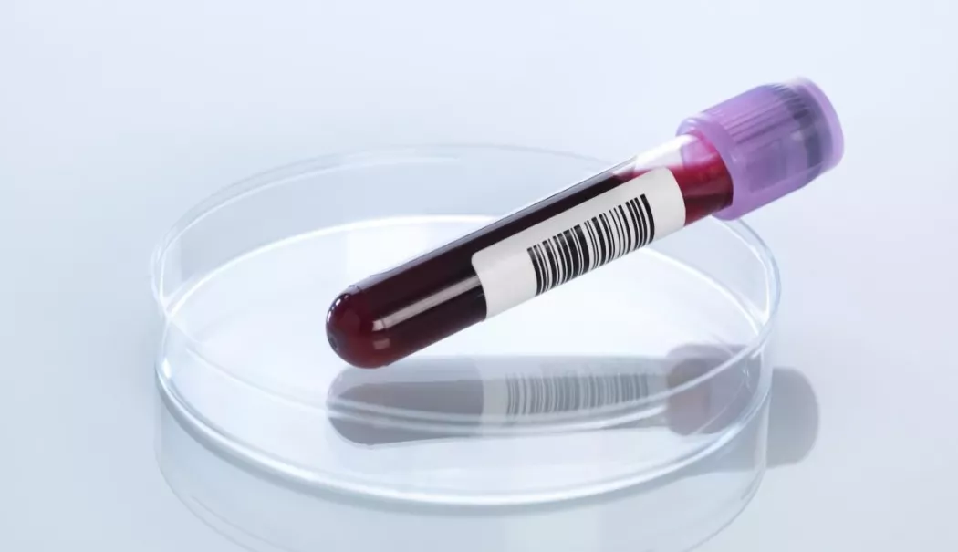 Sânge îngroșat? Ce opțiuni aveți pentru a preveni complicațiile periculoase - sange-1772546631.webp
