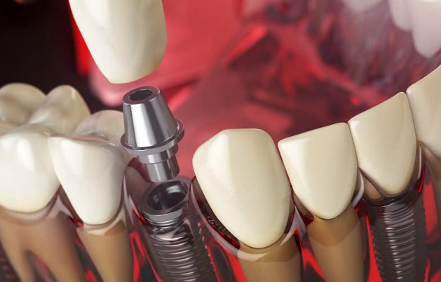 Bărbat găsit mort după depresie severă provocată de un tratament dentar eșuat în străinătate - screenshot-20260414-091319-1776147215.webp