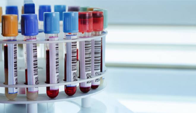 Se reiau testările gratuite pentru HIV și hepatită  în Spitalul Județean - sereiautestarile-1440427586.jpg