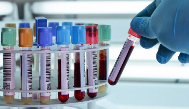 Un nou caz de variola maimuţei a fost confirmat în România
