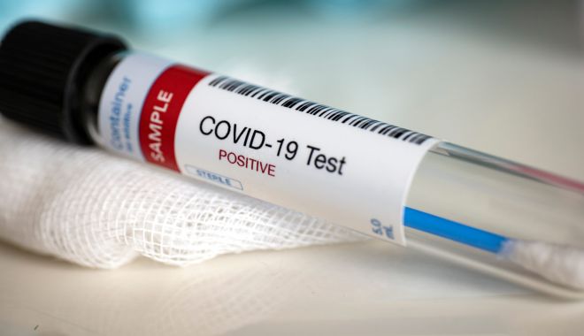 Coronavirus la Constanța. 6.257 de persoane au fost confirmate cu COVID până în prezent - shutterstock1673330692scaled-1604343434.jpg