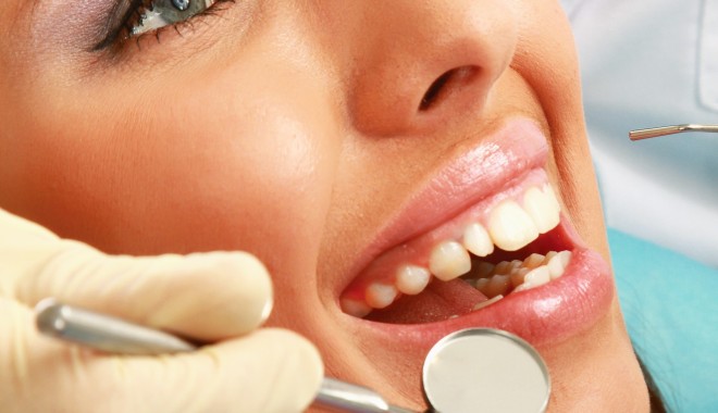 Care sunt beneficiile fațetelor dentare - shutterstock91257179copy-1363685415.jpg