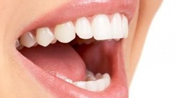 Cum să scapi de petele dentare - smile45698400-1369862901.jpg