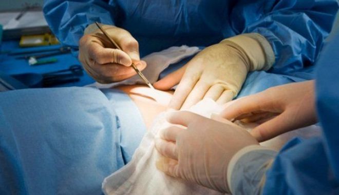 Pacient mort, după ce ar fi fost operat de un medic voluntar, și nu de cel care figura în documente - spitalmedicioperatie-1553174327.jpg