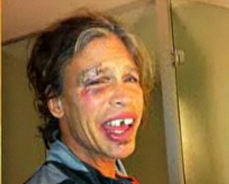 Ce a pățit Steve Tyler, de la Aerosmith - stevetyler-1319792317.jpg