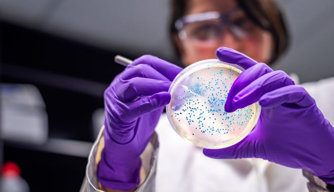 Alertă în Marea Britanie: șase copii au murit din cauza infecţiei cu streptococul A - streptococ-1670077181.jpg