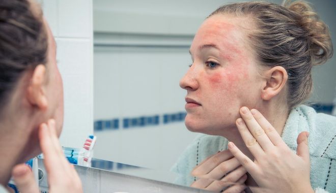 Remedii naturale care țin țânțarii la distanță - tantari-1676400944.jpg