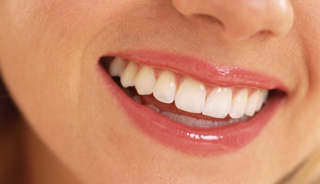 Cum se pot albi dinții pe cale naturală - teeth-1340120205.jpg