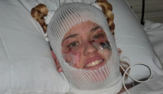 DRAMATIC! Medicii i-au AMPUTAT mâinile și picioarele, după nouă operații! - teribil-1364732118.jpg
