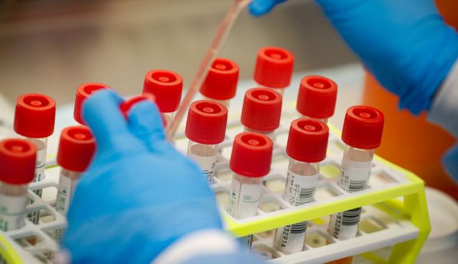 Un român mort de coronavirus acum o lună, raportat azi. Bilanțul urcă la 726 de decese din cauza COVID-19 - test-1588319491.jpg