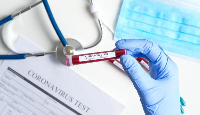 Focar de coronavirus într-un centru unde sunt internați copii și tineri infectați cu HIV - test-1590491893.jpg