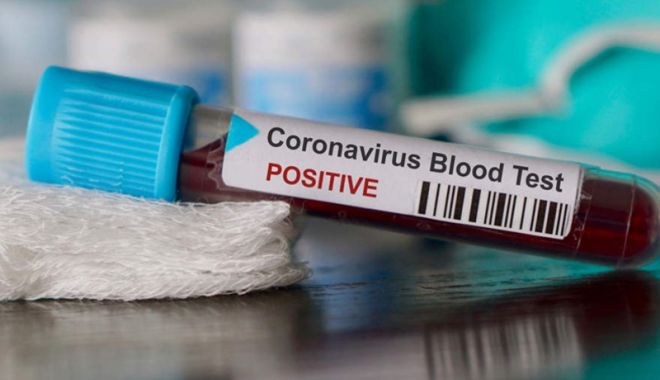 Coronavirus România: 187 de cazuri noi de coronavirus în ultimele 24 de ore - test-1591437966.jpg