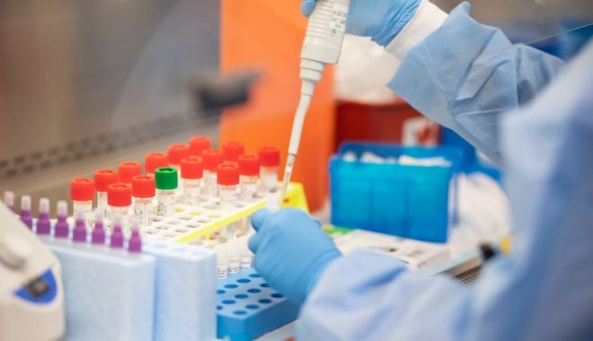 A fost inventat testul pentru coronavirus care dă rezultatul în 20 de minute - test-1594999774.jpg