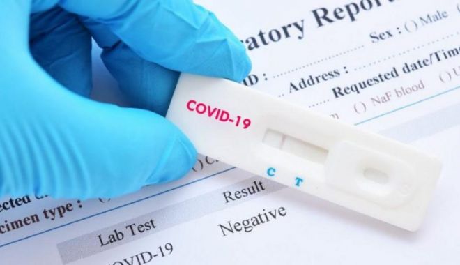 COVID-19. 32 de cazuri noi, confirmate în 24 de ore, în județul Constanța - test-1595585963.jpg