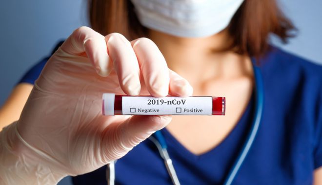 COVID-19. 1.215 cazuri noi de coronavirus în țară, 20 la Constanța - test-1597140237.jpg