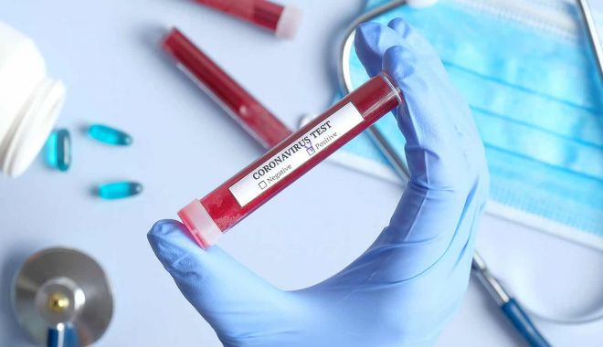 Cifre îngrijorătoare. 1.415 cazuri noi de coronavirus, în 24 de ore, 22 în județul Constanța - test-1597400229.jpg