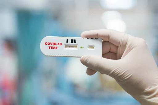 Un test care detectează Covid-19 în 10 secunde a fost inventat în Turcia - test-1609580266.jpg