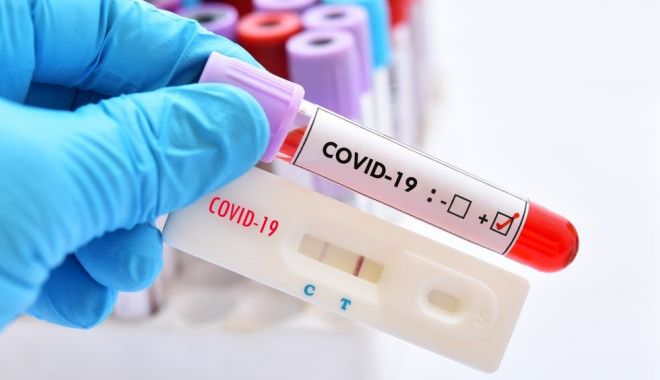 Studiu: Infecția cu coronavirus asigură un grad de imunitate similar vaccinurilor anti-Covid - test-1614238435.jpg