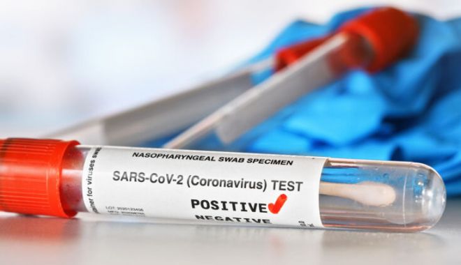 Coronavirus în România: Peste 10.000 de cazuri noi de infectare în 24 de ore - test-1642237415.jpg