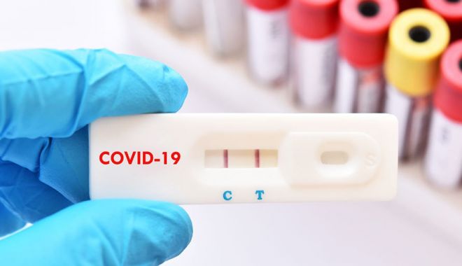 COVID-19. Mai puţine teste, mai puţine cazuri noi - test2-1615116695.jpg