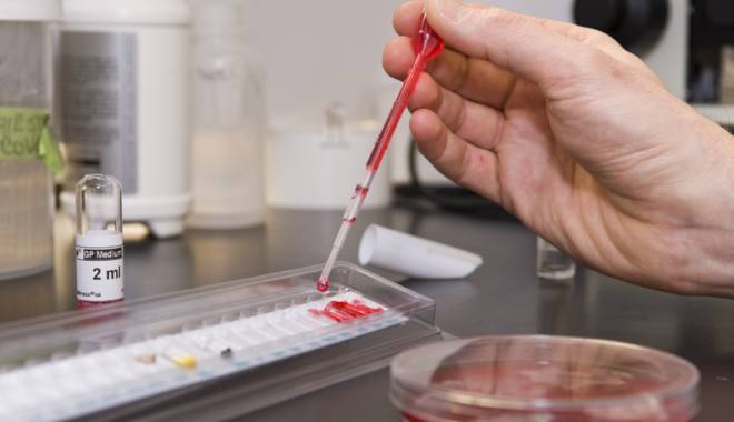 Testări gratuite pentru hepatita C - testarigratuite-1415894940.jpg