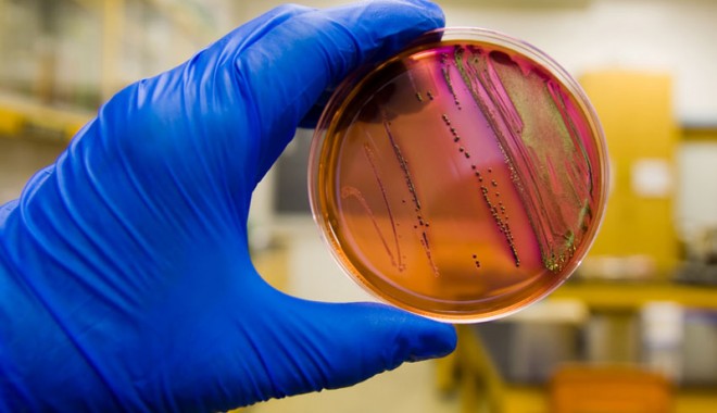 Cancerul de col uterin, depistat printr-o nouă metodă - testcancercol-1355241281.jpg