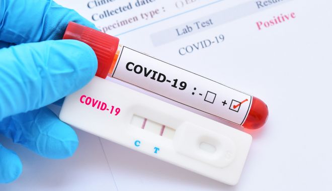 EXPLOZIE A CAZURILOR DE COVID! Constanţa, în topul judeţelor cu cele mai multe îmbolnăviri - testcovid19shutterstock169237076-1657623825.jpg