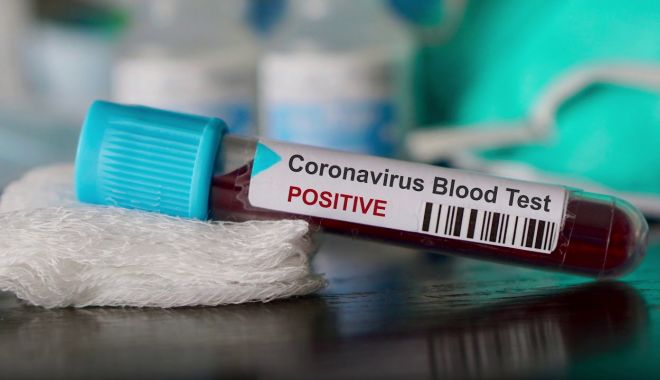 Coronavirus la Constanța. 3,118 persoane au fost infectate cu COVID până în prezent - testcovid2-1601737518.jpg