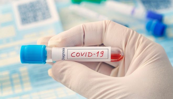 COVID-19. Începe să crească numărul infectărilor zilnice - testcovidcoronavirus3-1609847499.jpg