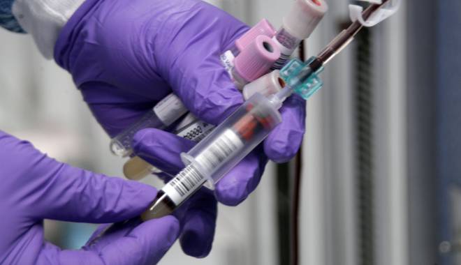 Teste gratuite de hepatită pentru constănțeni - teste-1443620902.jpg
