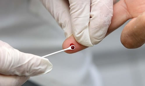 Până la 18 ani, testarea pentru HIV se face doar cu acordul părinților - testedehiv-1484912512.jpg