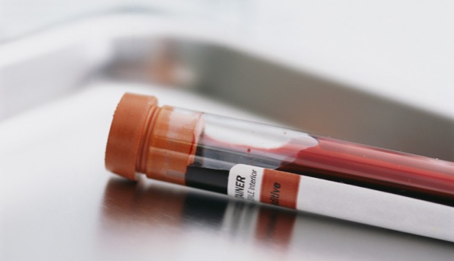 Teste gratuite de sănătate pentru constănțeni - testegratuitedesanatate-1393359397.jpg