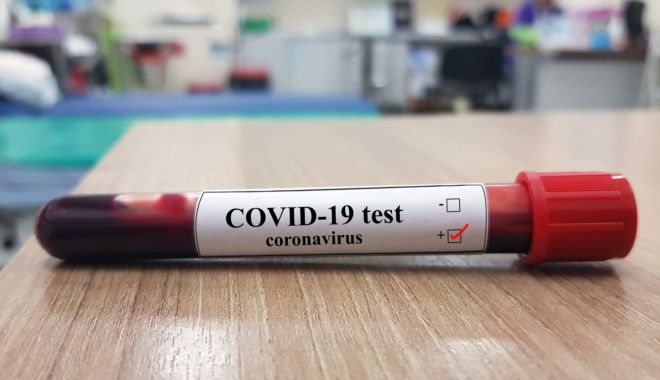Personalul medical al Spitalului Județean, testat împotriva Covid-19 - testesursaeconomicanet-1586882377.jpg