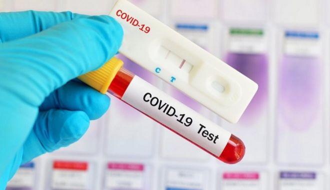 Aproximativ 820.000 teste pentru depistarea Covid 19, efectuate în octombrie - testesursatv8md-1604221445.jpg