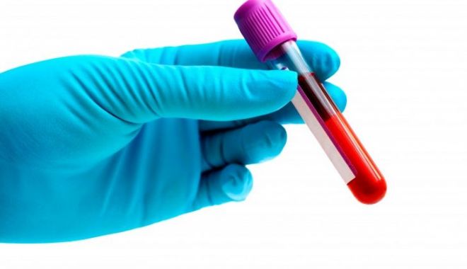 Preşedinte diagnosticat cu cancer de sânge! Boala, asimptomatică până la 60 de ani - testsange-1655796956.jpg