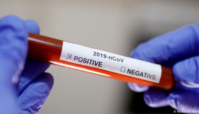 Coronavirus / Peste 3.000 de noi cazuri de infectare în ultimele 24 de ore - testtt-1610796081.jpg