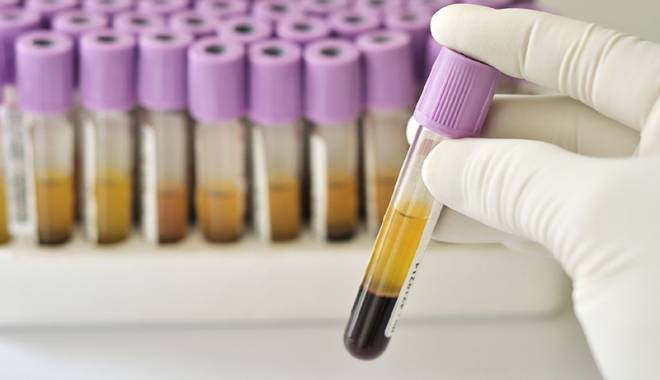 Testul pentru hepatită. Află dacă ai un ficat bolnav - testulpentru-1440343998.jpg