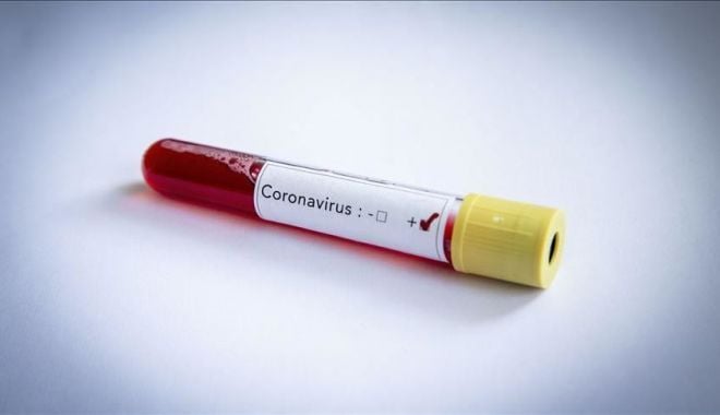 Bilanț Covid: 1.632 cazuri noi înregistrate în ultimele 24 de ore - thumbsbcabffe076c745d4bfdac0b188-1620296800.jpg
