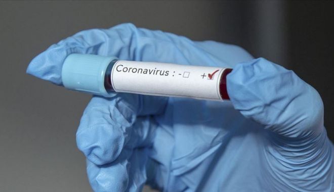 COVID-19. Încă o zi cu teste puţine şi cu incidenţă în scădere, în judeţul Constanţa - thumbsbcb7df060635df1a9b9e39f1c3-1620124917.jpg