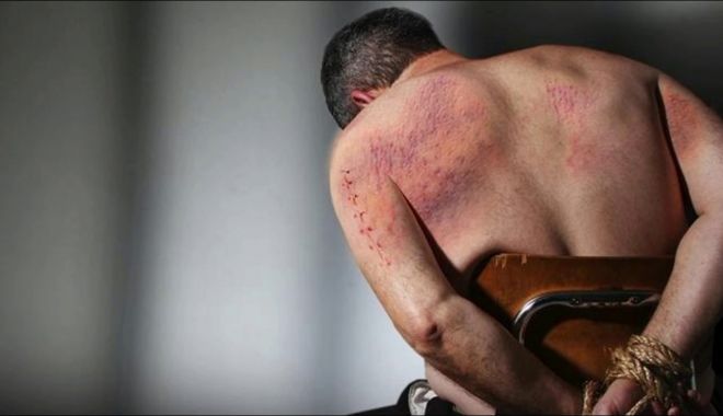 Astăzi se sărbătoreşte Ziua internaţională pentru sprijinirea victimelor torturii - tortura-1624688545.jpg