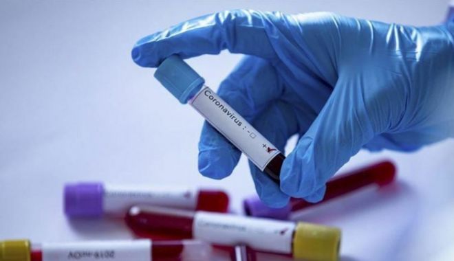 Infecţia cu noul coronavirus creşte din cauza transmiterii comunitare mai intense - transmiteresursazgd-1601533053.jpg