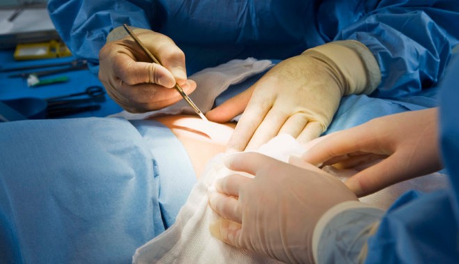 Record la transplanturile renale - transplant-1399467387.jpg