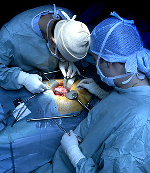 China renunță să mai preleveze organe de la deținuții executați - transplant02-1383393069.jpg