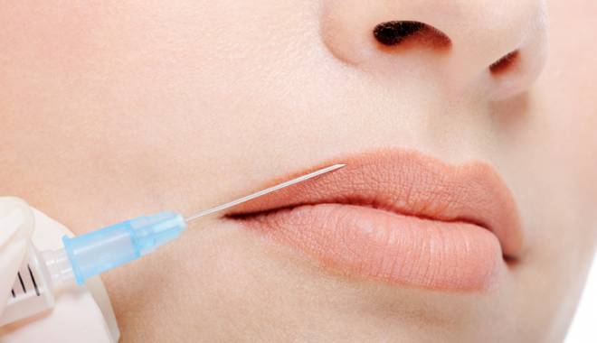 Tratament cu acid hialuronic pentru buze ca de divă, la Iowemed - tratamentcuacidhialuronic-1443020329.jpg